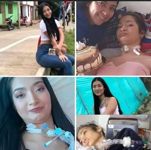 Pysu “I’m dead in life”: Erika is 20 years old and requested euthanasia after being left quadriplegic by a bottle…See More